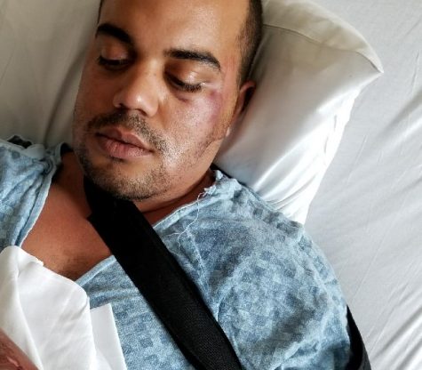 Vince Iventosch was struck by a vehicle in the parking lot of a local restaurant (Port City Daily photo/COURTESY SANDI IVENTOSCH) 