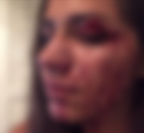 [Click to show un-blurred photo.] A friend took this photo of Kimberly Rhine after she was allegedly assaulted by her then-boyfriend, a special forces Marine. (Port City Daily photo / Courtesy Kimberly Rhine)